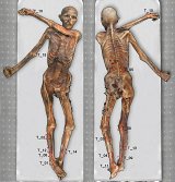 Répartition des tatouages sur le corps momifié d'Ötzi